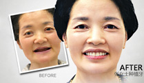 让母亲拥有一口健康牙